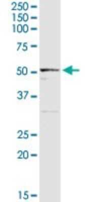 Western Blot: ALDH3B1 Antibody [H00000221-D01P]