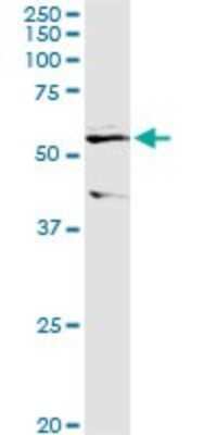 Western Blot: ALDH3B1 Antibody [H00000221-D01P]