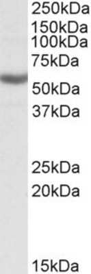 Western Blot: ALDH3B1 Antibody [NBP1-52054]