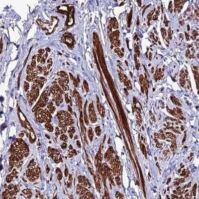 Immunohistochemistry-Paraffin: ALDH3B2 Antibody [NBP1-89148]