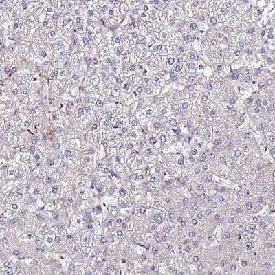 Immunohistochemistry-Paraffin: ALDH3B2 Antibody [NBP1-89148]