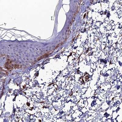 Immunohistochemistry-Paraffin: ALDH3B2 Antibody [NBP1-89148]