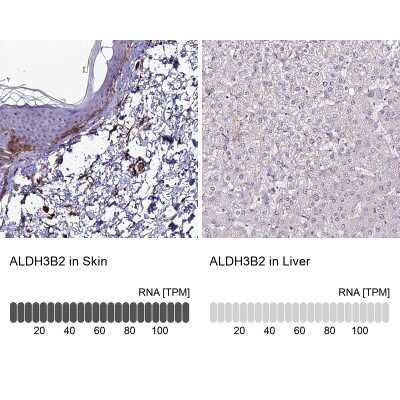 Immunohistochemistry-Paraffin: ALDH3B2 Antibody [NBP1-89148]