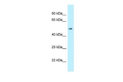 Western Blot: ALDH3B2 Antibody [NBP2-86976]