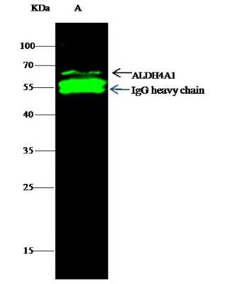 Immunoprecipitation: ALDH4A1 Antibody (001) [NBP2-90151]