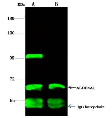 Immunoprecipitation: ALDH4A1 Antibody (002) [NBP2-90152]