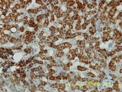 Immunohistochemistry-Paraffin: ALDH4A1 Antibody (1A12-A5) [H00008659-M01]