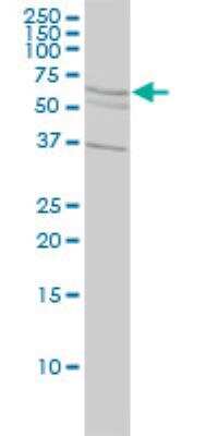 Western Blot: ALDH4A1 Antibody (1A12-A5) [H00008659-M01]