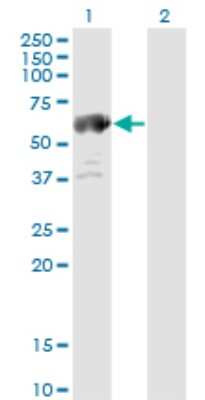 Western Blot: ALDH4A1 Antibody (1A12-A5) [H00008659-M01]