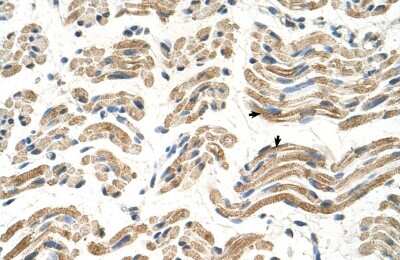 Immunohistochemistry-Paraffin: ALDH4A1 Antibody [NBP1-54740]