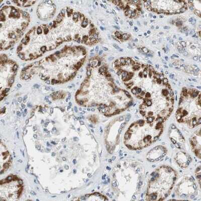 Immunohistochemistry-Paraffin: ALDH4A1 Antibody [NBP1-89149]