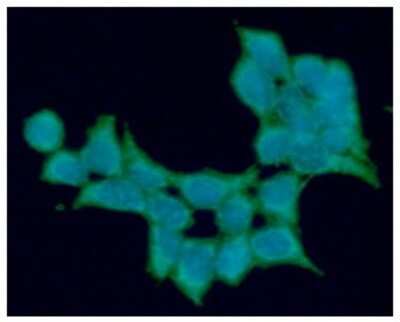 Immunocytochemistry/ Immunofluorescence: ALDH5A1 Antibody (17F5) - BSA Free [NBP2-59409]