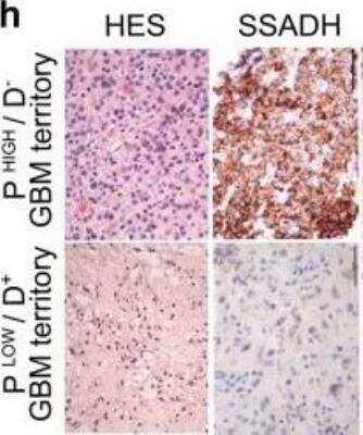 Immunohistochemistry: ALDH5A1 Antibody (17F5) - BSA Free [NBP2-59409]