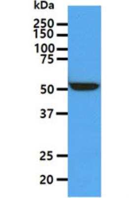 Western Blot: ALDH5A1 Antibody (17F5)BSA Free [NBP2-59409]