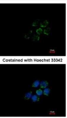 Immunocytochemistry/ Immunofluorescence: ALDH5A1 Antibody [NBP1-32970]