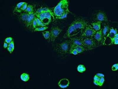 Immunocytochemistry/ Immunofluorescence: ALDH5A1 Antibody [NBP2-98042]