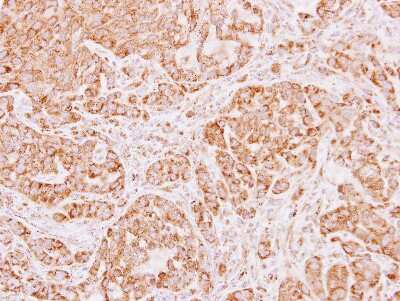 Immunohistochemistry-Paraffin: ALDH5A1 Antibody [NBP1-32970]