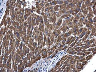 Immunohistochemistry-Paraffin: ALDH5A1 Antibody [NBP1-32970]