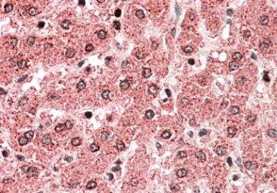 Immunohistochemistry-Paraffin: ALDH5A1 Antibody [NBP1-52099]