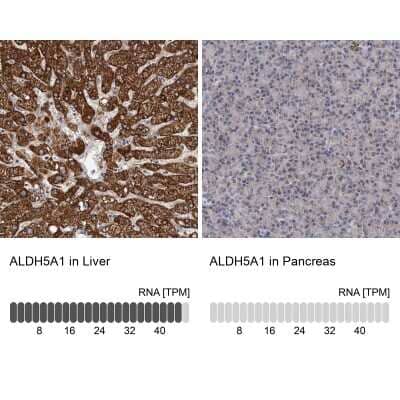 Immunohistochemistry-Paraffin: ALDH5A1 Antibody [NBP1-86996]