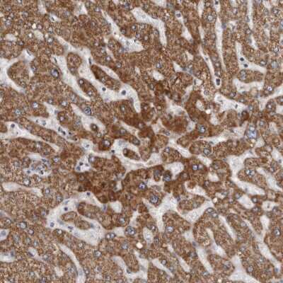 Immunohistochemistry-Paraffin: ALDH5A1 Antibody [NBP1-86997]