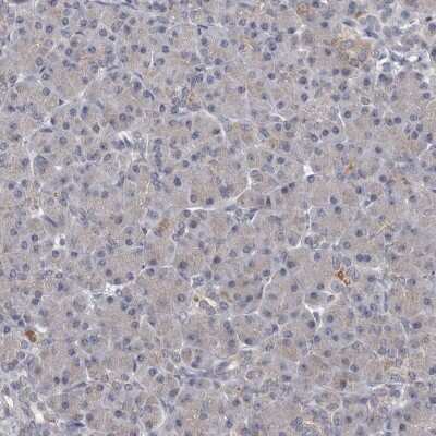 Immunohistochemistry-Paraffin: ALDH5A1 Antibody [NBP1-86997]