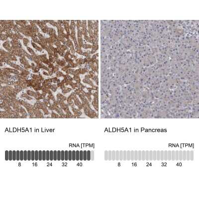 Immunohistochemistry-Paraffin: ALDH5A1 Antibody [NBP1-86997]