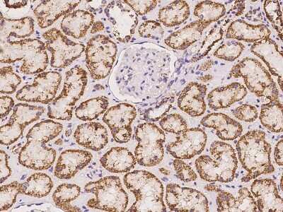 Immunohistochemistry-Paraffin: ALDH5A1 Antibody [NBP2-98042]