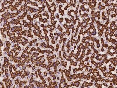 Immunohistochemistry-Paraffin: ALDH5A1 Antibody [NBP2-98042]