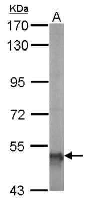 Western Blot: ALDH5A1 Antibody [NBP1-32970]