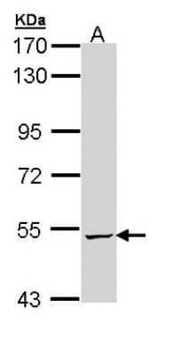 Western Blot: ALDH5A1 Antibody [NBP1-32970]