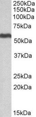 Western Blot: ALDH5A1 Antibody [NBP1-52099]