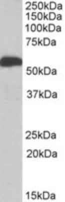 Western Blot: ALDH5A1 Antibody [NBP1-52100]