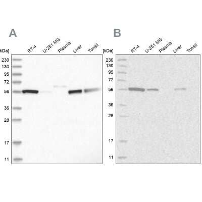 Western Blot: ALDH5A1 Antibody [NBP1-86997]