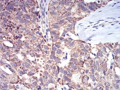 Immunohistochemistry: ALDH6A1 Antibody (6H9B7) - BSA Free [NBP2-52411]