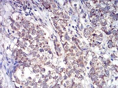 Immunohistochemistry: ALDH6A1 Antibody (6H9B7) - BSA Free [NBP2-52411]