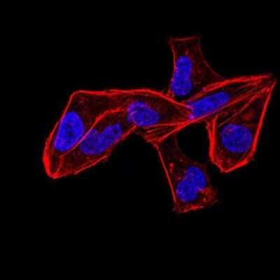 Immunocytochemistry/ Immunofluorescence: ALDH6A1 Antibody (6H9B8) - BSA Free [NBP2-52410]