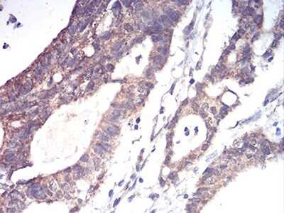 Immunohistochemistry: ALDH6A1 Antibody (6H9B8) - BSA Free [NBP2-52410]