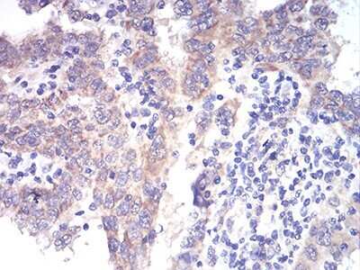 Immunohistochemistry: ALDH6A1 Antibody (6H9B8) - BSA Free [NBP2-52410]