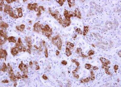 Immunohistochemistry-Paraffin: ALDH6A1 Antibody [NBP1-32381]