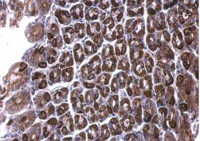 Immunohistochemistry-Paraffin: ALDH6A1 Antibody [NBP1-32381]