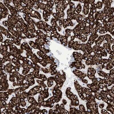 Immunohistochemistry-Paraffin: ALDH6A1 Antibody [NBP1-82634]