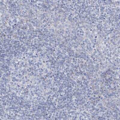 Immunohistochemistry-Paraffin: ALDH6A1 Antibody [NBP1-82634]