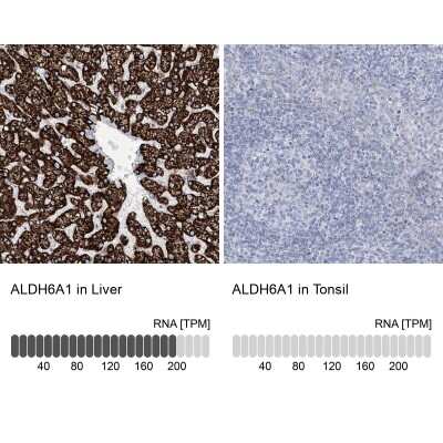 Immunohistochemistry-Paraffin: ALDH6A1 Antibody [NBP1-82634]