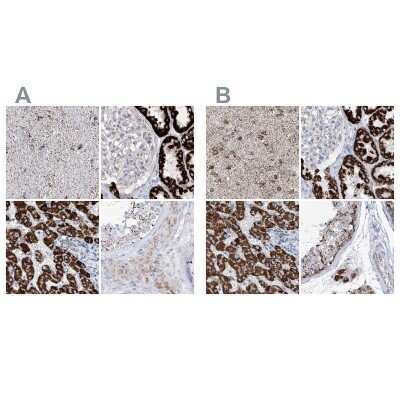 Immunohistochemistry-Paraffin: ALDH6A1 Antibody [NBP1-82634]
