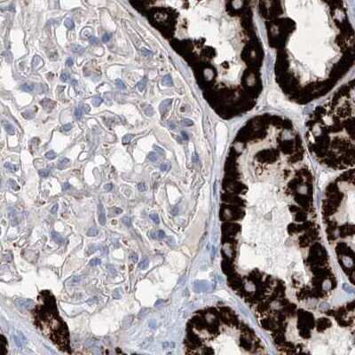 Immunohistochemistry-Paraffin: ALDH6A1 Antibody [NBP1-82634]