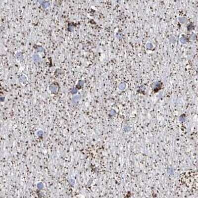 Immunohistochemistry-Paraffin: ALDH6A1 Antibody [NBP1-82634]