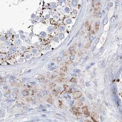 Immunohistochemistry-Paraffin: ALDH6A1 Antibody [NBP1-82634]