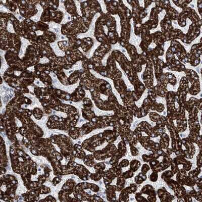 Immunohistochemistry-Paraffin: ALDH6A1 Antibody [NBP1-82635]
