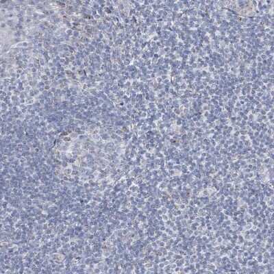 Immunohistochemistry-Paraffin: ALDH6A1 Antibody [NBP1-82635]